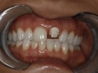 Konig Center for Cosmetic & Comprehensive Dentistry smile photos